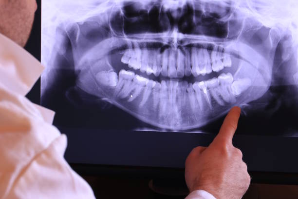 Best Emergency Dental Care for Sports Injuries in Solomons, MD
