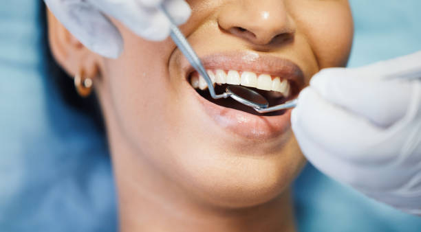 Best Weekend Emergency Dental Services in Solomons, MD