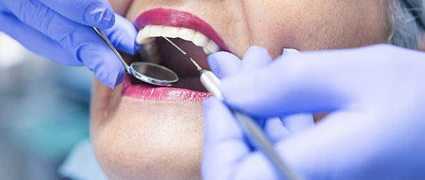 Best Emergency Pediatric Dental Care in Solomons, MD